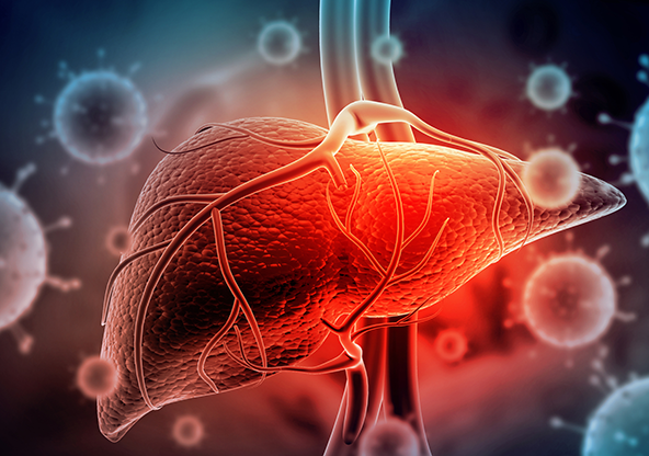 A diseased human liver